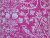 Hot Pink Magenta Cross Back Apron fabric closeup